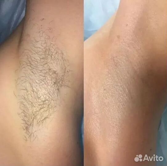 Мастер шугаринга