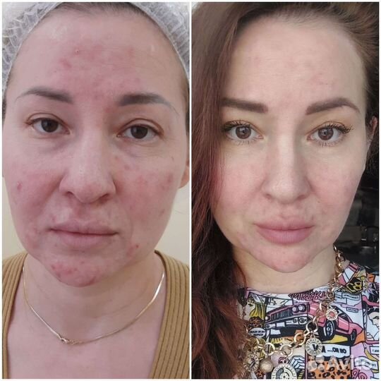 Косметология/ депиляция/обучение депиляции