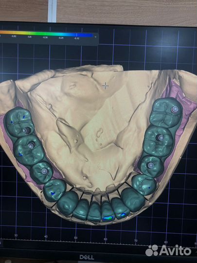 Диоксид циркония за 3 дня 4000/ед