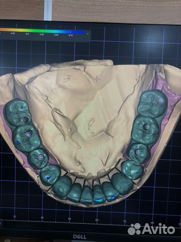 Диоксид циркония за 3 дня 4000/ед