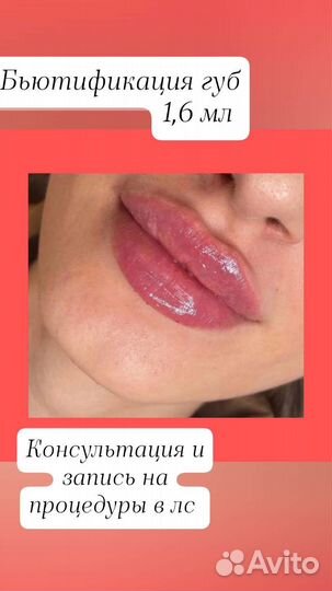 Инъекции ботокса в подмышки
