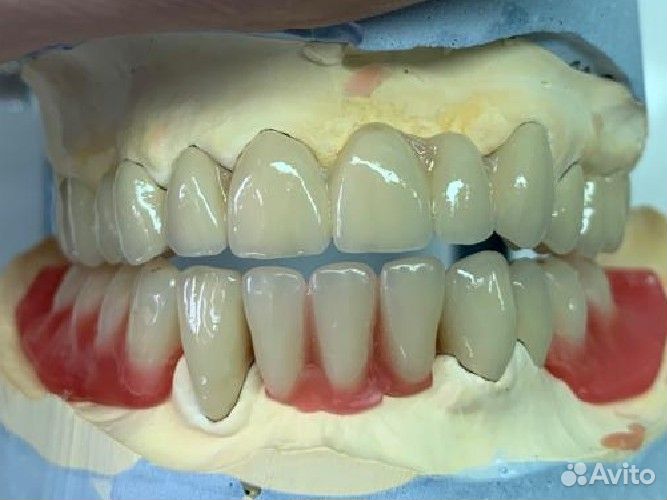 Зубной техник cad cam