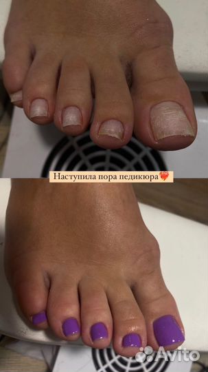 Услуги маникюра и педикюра