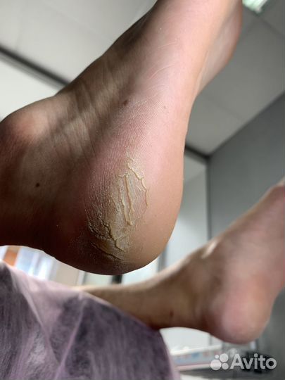 Маникюр педикюр Ангарск