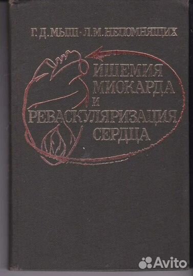 Ишемия миокарда и реваскуляризация сердца