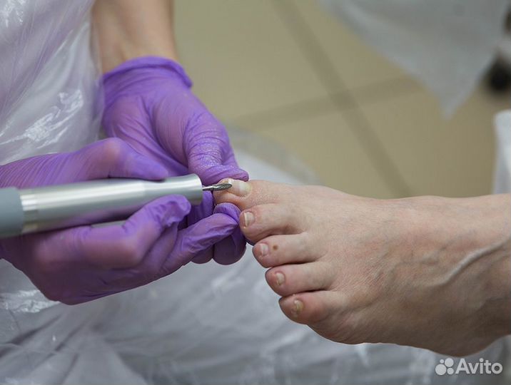 Медицинский педикюр - Подолог