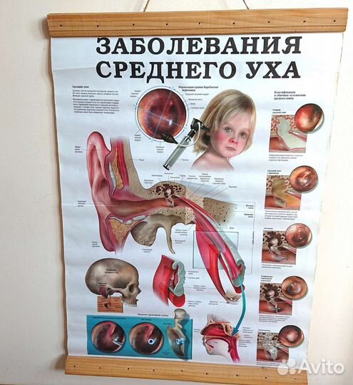 Плакат медицинский учебный