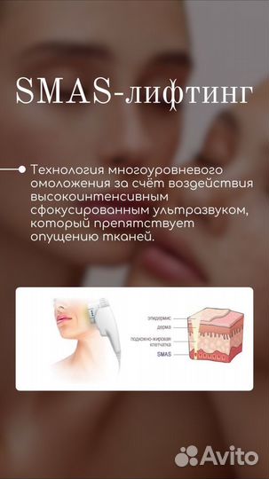 SMAS лифтинг лица