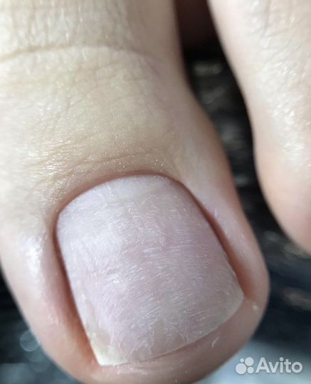 Педикюр с покрытием лаком