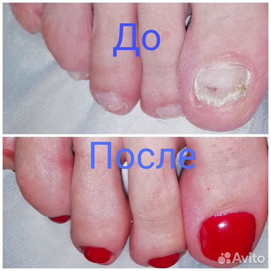 Педикюр + Маникюр +Депиляция