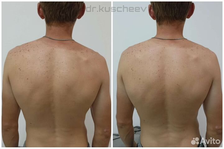 Мануальный массаж Анапа