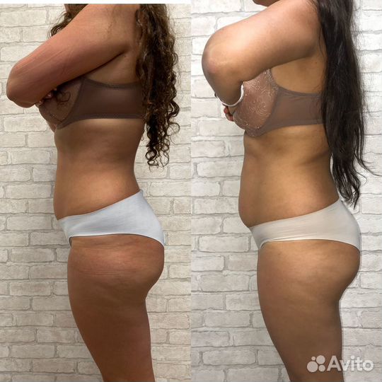 LPG лпж массаж в Красноярске