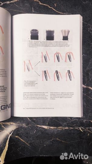 Нулевая утрата кости книга