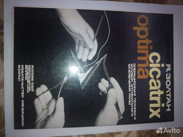 Операционная техника Ян Золтан 1983 г