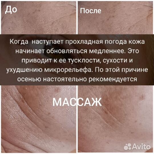 Массаж лица