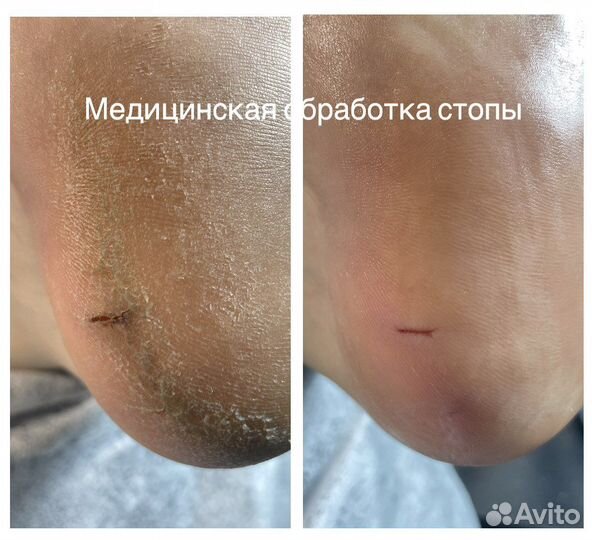 Маникюр и педикюр