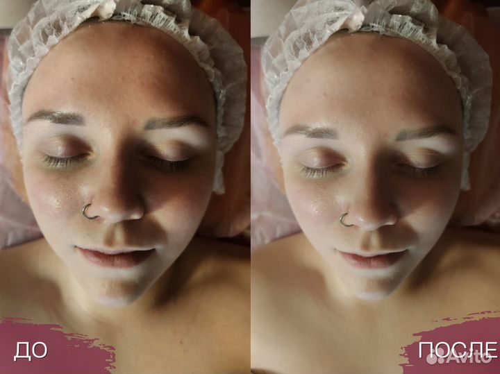 Массаж лица. Косметолог