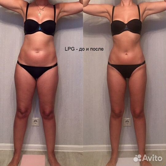 LPG, массаж, микротоки, LPG обучение+сертификат