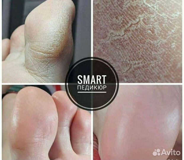 Педикюр, маникюр на дому