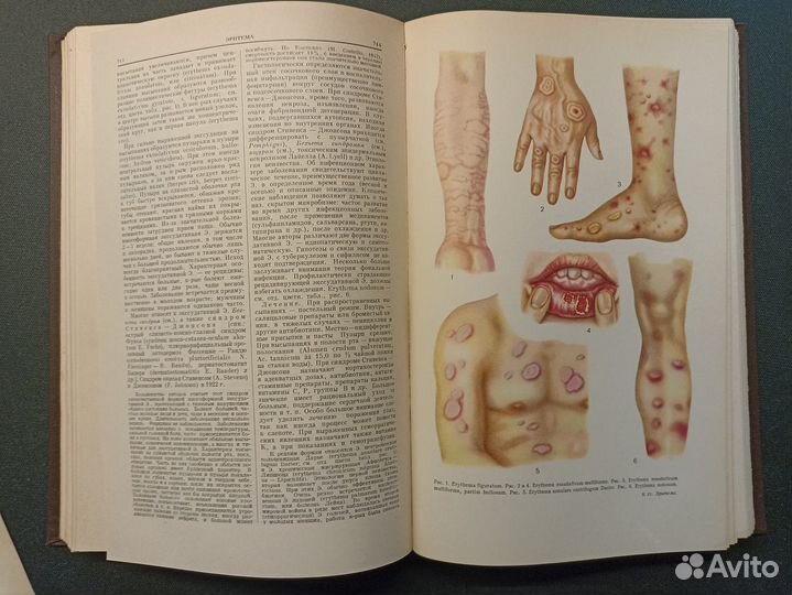 Большая медицинская энциклопедия. Том 35. 1964 