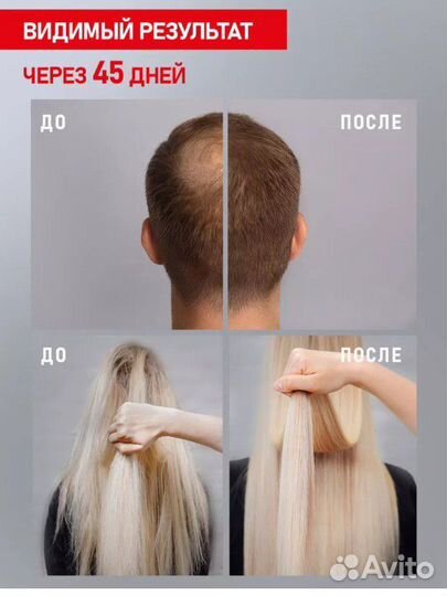 Спрей против выпадения волос новый