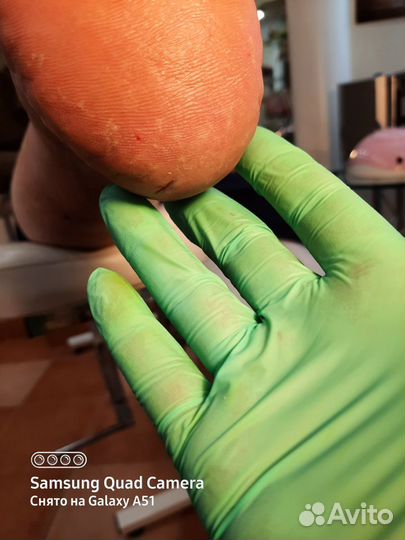 Гигиенический педикюр для ваших красивых ножек