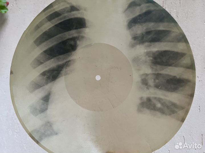 Грамзаписи музыка на рёбрах, костях самиздат