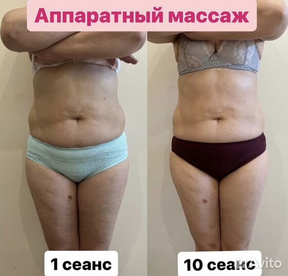 Аппаратный массаж. Антицеллюлитный. Коррекция фигу