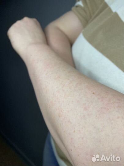 Депиляция воском и шугаринг