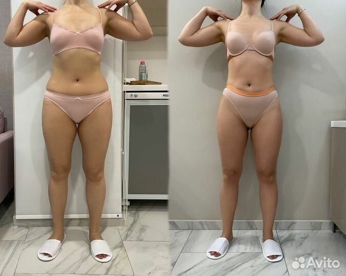 Эндосфера массаж - Коррекция фигуры