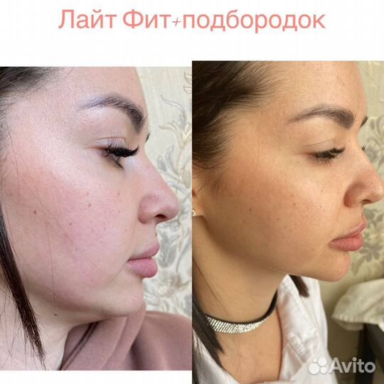 Услуги косметолога