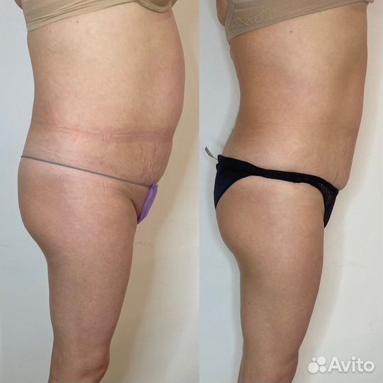 Массаж тела