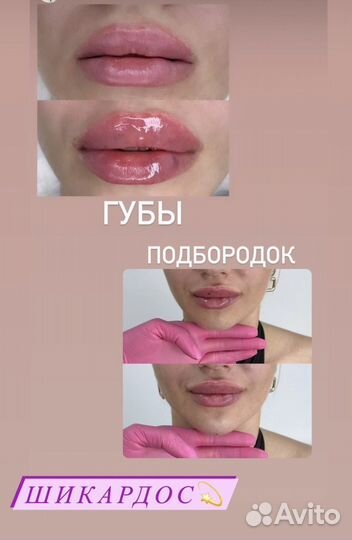 Услуги косметолога