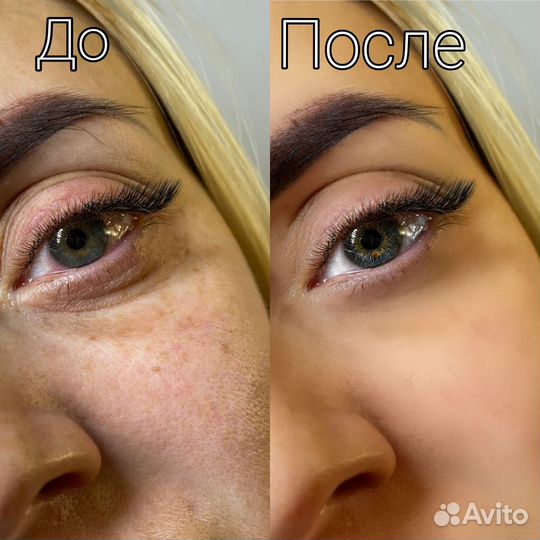 Ретушь фото бьюти-мастерам