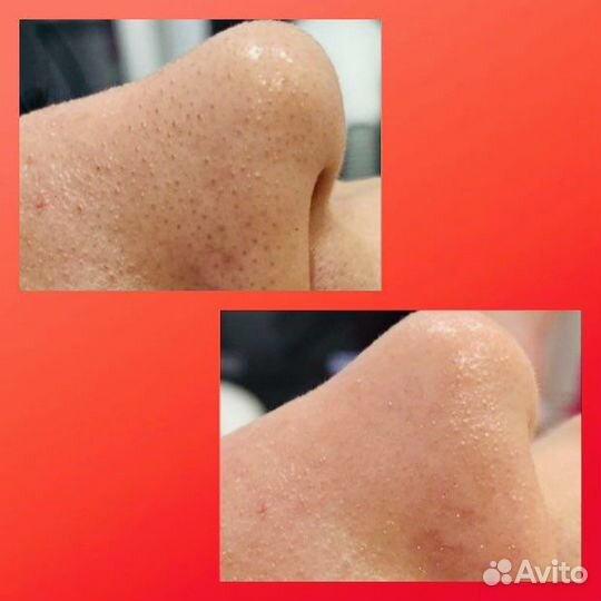 Косметология, массаж