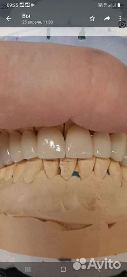 Зубной техник.Стоматология-Ортопедия