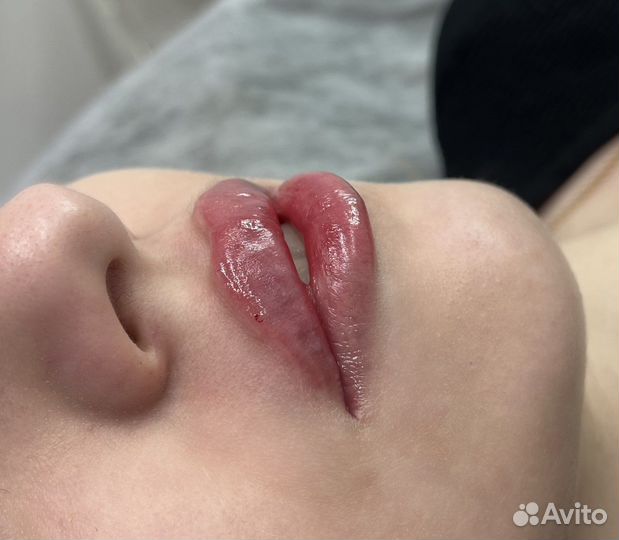 Косметолог. Губы