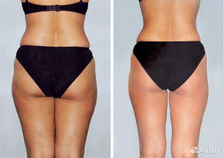 Модель на LPG