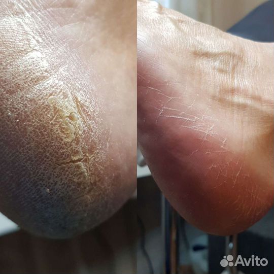 Маникюр, педикюр,подология в алтуфьево