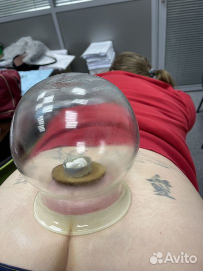 Купон на гирудотерапию