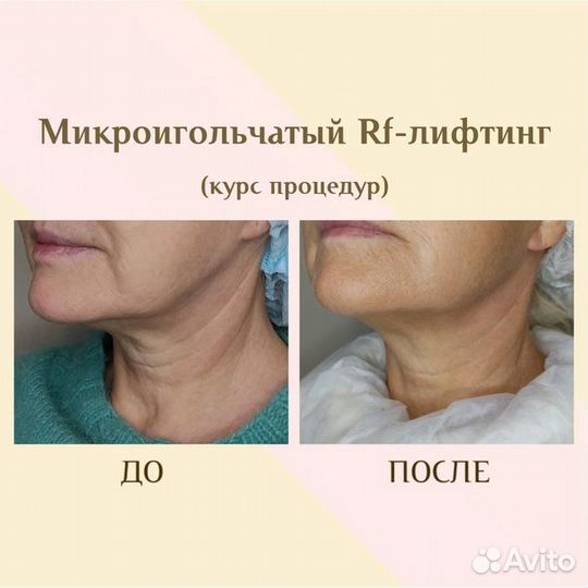 Косметологические услуги