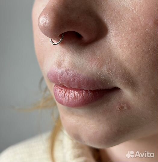 Пирсинг и микродермалы