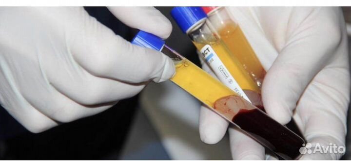 Плазмолифтинг