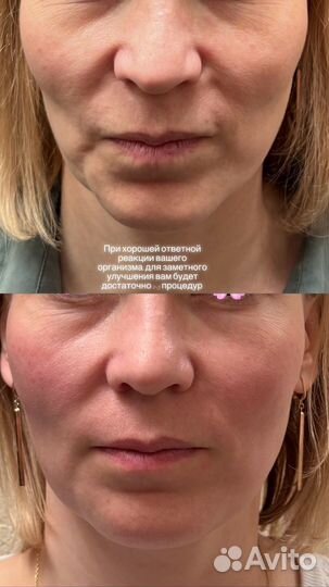 Avocado massage studio