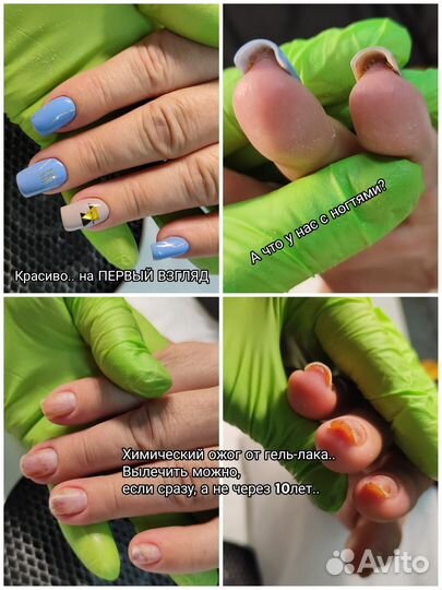 Подологический маникюр (мужской, женский, детский)