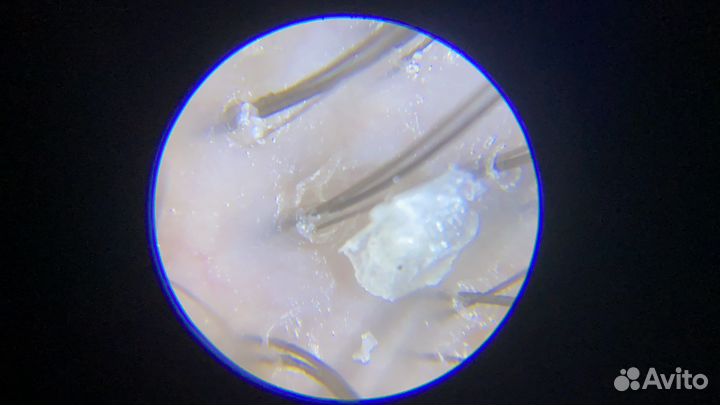 Пилинг для кожи головы подбор домашнего ухода