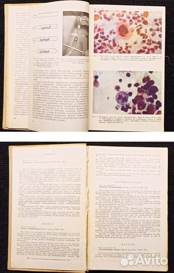 Клиническая трансплантология. Коваленко. 1975