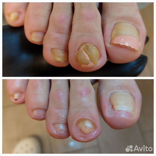 Подолог студия подологии выезд на дом