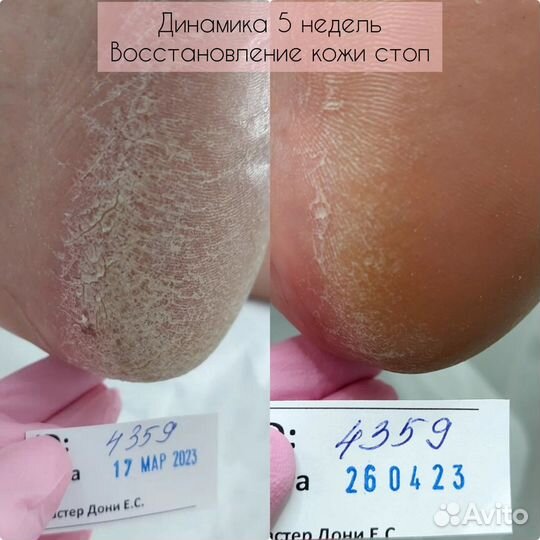 Специалист - подолог