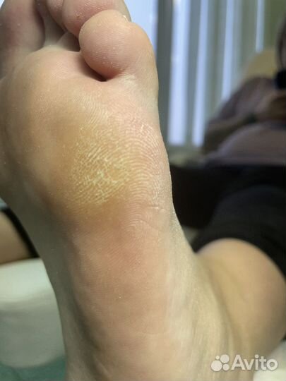 Педикюр подолог